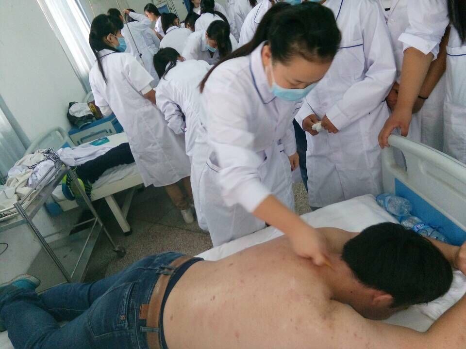 华宇卫校学生中医针灸、刮痧和拔罐实训课06